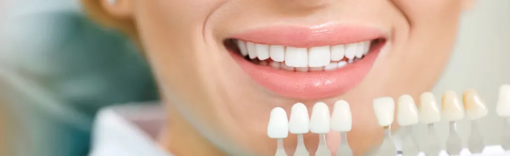 ホワイトニングとは