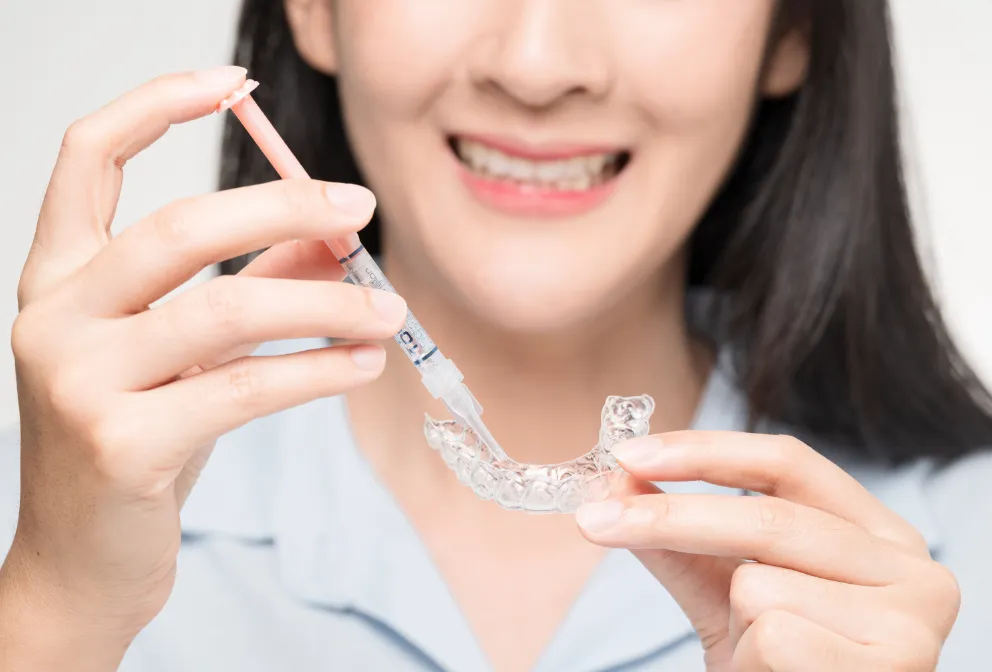 ホームホワイトニング