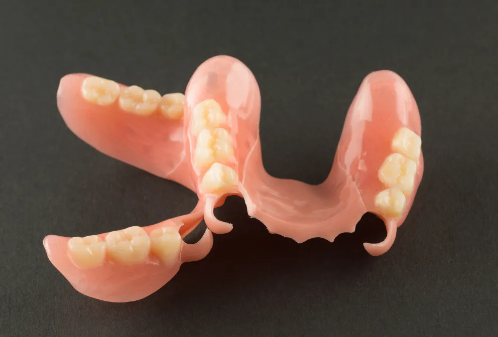 ノンクラスプデンチャー