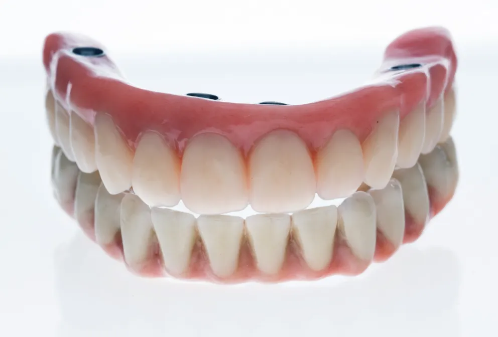 マグネットデンチャー