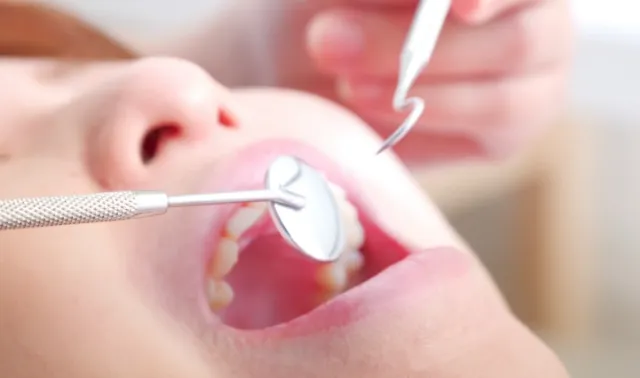 歯周病の初期治療