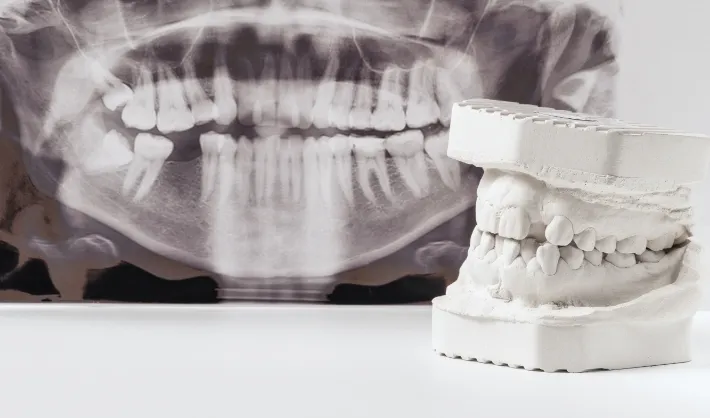 歯並びと噛み合わせについて