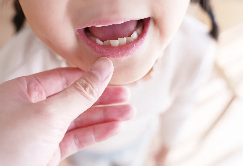 永久歯が正しく生えるように誘導できる