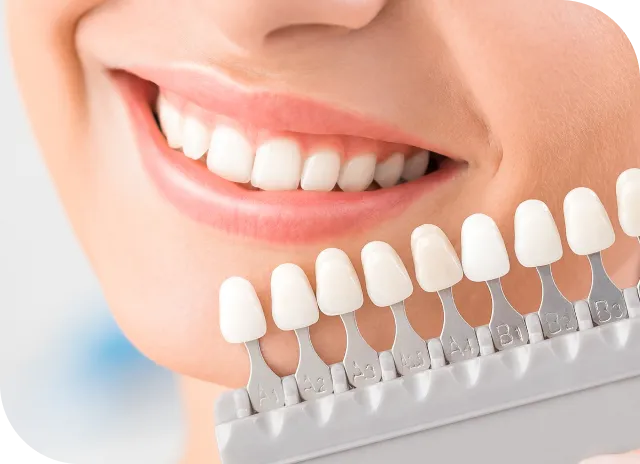 セラミック・審美歯科