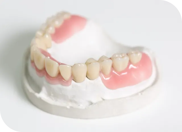 義歯・入れ歯